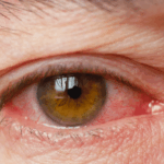 Cerca de 300 mil idosos brasileiros têm algum grau de TEA, diz estudo