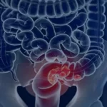 CADE intima Apple para explicar restrições ao Pix por aproximação no iPhone