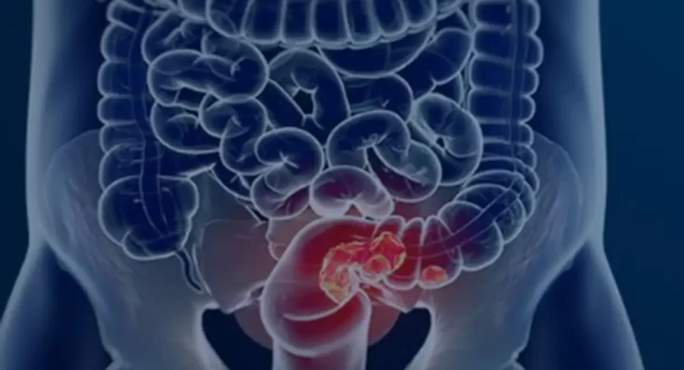 © Câmara Municipal de Afonso Claudio/Divulgação