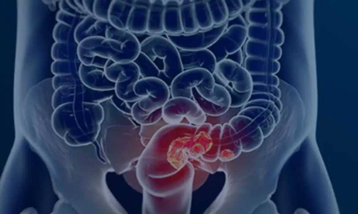 © Câmara Municipal de Afonso Claudio/Divulgação